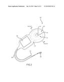 IMPLANTABLE AUDITORY PROSTHESIS HAVING ISOLATED COMPONENTS diagram and image