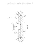 IMPLANTABLE AUDITORY PROSTHESIS HAVING ISOLATED COMPONENTS diagram and image