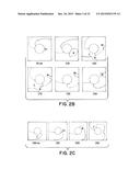 Method for Low-Voltage Termination of Cardiac Arrhythmias by Effectively     Unpinning Anatomical Reentries diagram and image