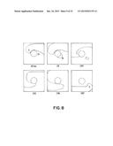 Method for Low-Voltage Termination of Cardiac Arrhythmias by Effectively     Unpinning Anatomical Reentries diagram and image