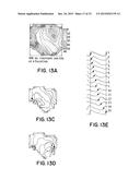 Method for Low-Voltage Termination of Cardiac Arrhythmias by Effectively     Unpinning Anatomical Reentries diagram and image