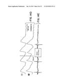 Method for Low-Voltage Termination of Cardiac Arrhythmias by Effectively     Unpinning Anatomical Reentries diagram and image