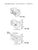 Method for Low-Voltage Termination of Cardiac Arrhythmias by Effectively     Unpinning Anatomical Reentries diagram and image