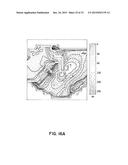 Method for Low-Voltage Termination of Cardiac Arrhythmias by Effectively     Unpinning Anatomical Reentries diagram and image