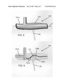 EXERCISE APPARATUS AND METHOD diagram and image