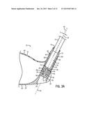 GOLF CLUB ADJUSTABLE HOSEL ASSEMBLY diagram and image