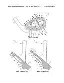 IMPROVED TRUSSES FOR GOLF CLUB HEADS diagram and image