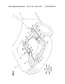 DIFFERENT MATERIALS JOINT STRUCTURE diagram and image