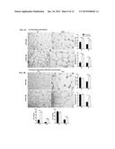 ANTI-HISTONE THERAPY FOR VASCULAR NECROSIS IN SEVERE GLOMERULONEPHRITIS diagram and image