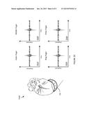 SYSTEMS, ARTICLES, AND METHODS FOR WEARABLE HUMAN-ELECTRONICS INTERFACE     DEVICES diagram and image