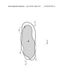 SHAPE SIMILARITY MEASURE FOR BODY TISSUE diagram and image