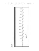 VOICE DATA PLAYBACK SPEED CONVERSION METHOD AND VOICE DATA PLAYBACK SPEED     CONVERSION DEVICE diagram and image