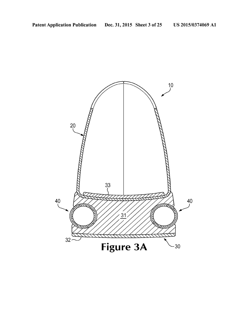 Strand-Wound Bladder - diagram, schematic, and image 04