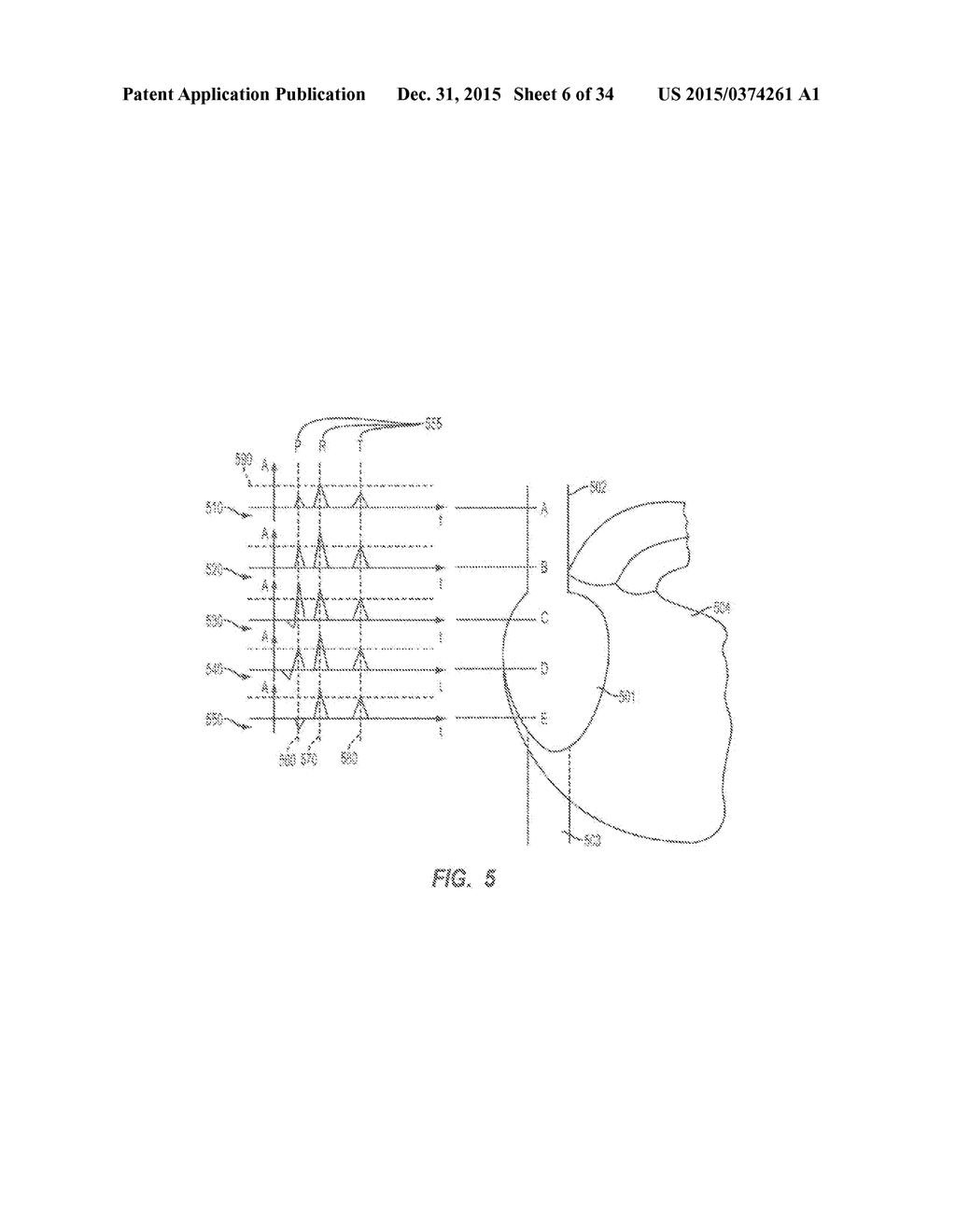 Apparatus and Method for Catheter Navigation and Tip Location - diagram, schematic, and image 07