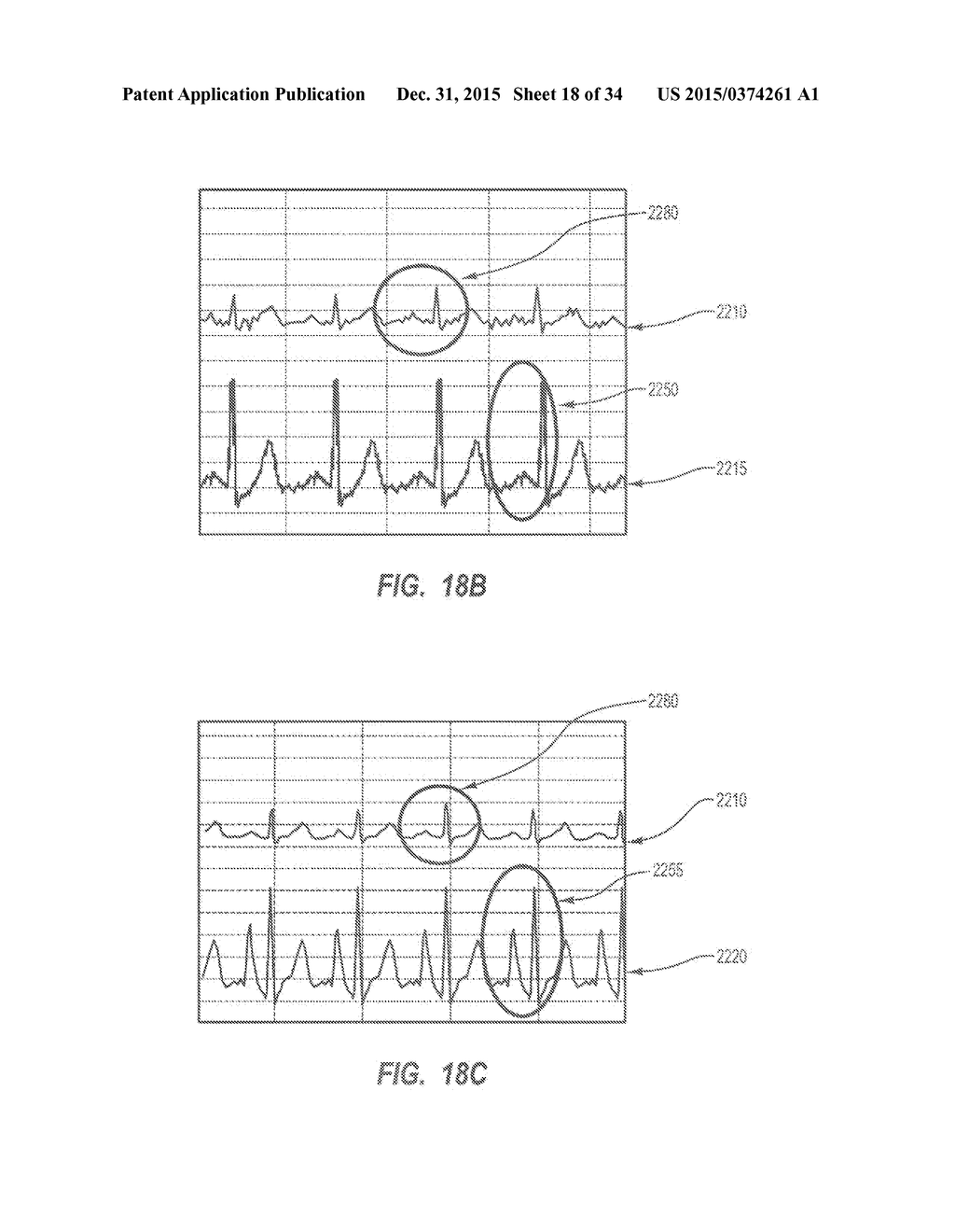 Apparatus and Method for Catheter Navigation and Tip Location - diagram, schematic, and image 19