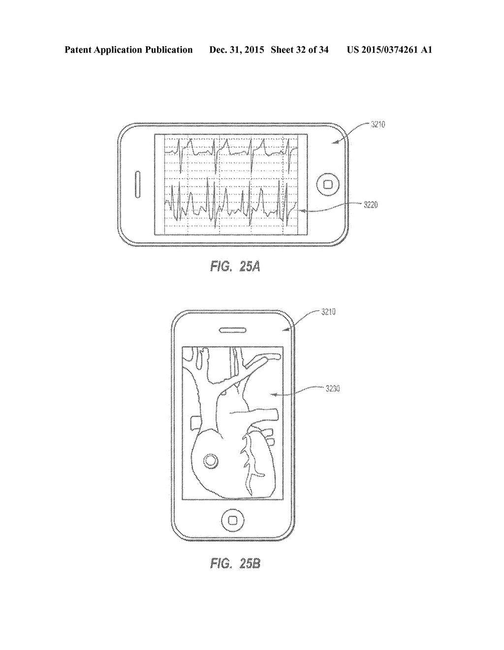 Apparatus and Method for Catheter Navigation and Tip Location - diagram, schematic, and image 33