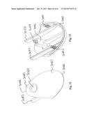 LANCING DEVICE WITH DEPTH ADJUSTMENT AND LANCET REMOVAL SYSTEM AND METHOD diagram and image