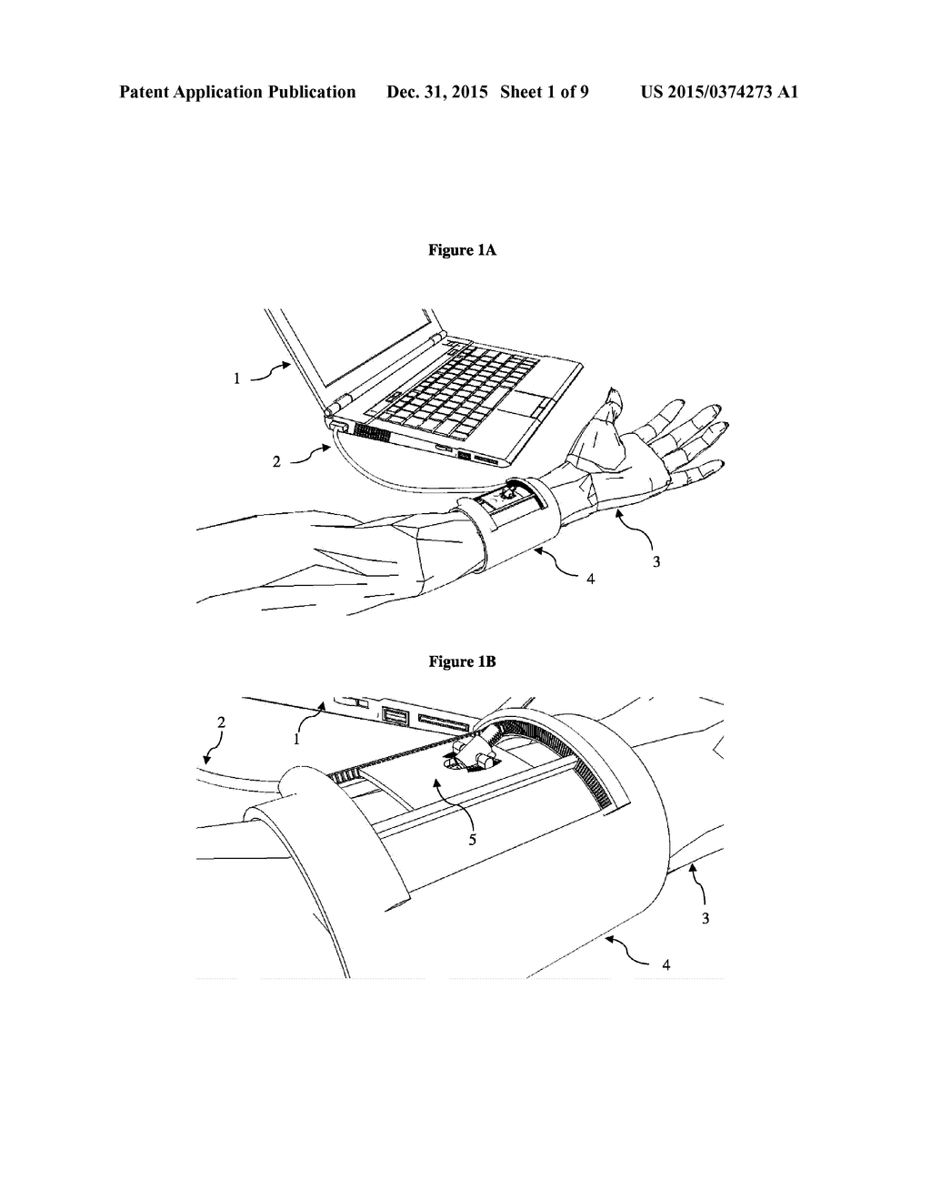 AUTOMATED VESSEL PUNCTURE DEVICE USING THREE-DIMENSIONAL(3D) NEAR INFRARED     (NIR) IMAGING AND A ROBOTICALLY DRIVEN NEEDLE - diagram, schematic, and image 02