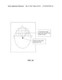 SYSTEMS, METHODS, AND COMPUTER-READABLE MEDIA FOR TIME LAPSE IMAGE     COMPARISON IN GENETIC DISORDER ANALYSIS diagram and image