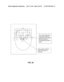 SYSTEMS, METHODS, AND COMPUTER-READABLE MEDIA FOR TIME LAPSE IMAGE     COMPARISON IN GENETIC DISORDER ANALYSIS diagram and image