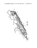 Suturing Devices and Methods for Closing a Patent Foramen Ovale diagram and image