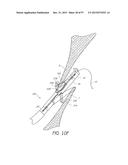 Suturing Devices and Methods for Closing a Patent Foramen Ovale diagram and image