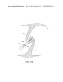 Suturing Devices and Methods for Closing a Patent Foramen Ovale diagram and image