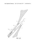 Suturing Devices and Methods for Closing a Patent Foramen Ovale diagram and image