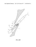 Suturing Devices and Methods for Closing a Patent Foramen Ovale diagram and image