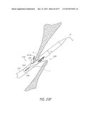 Suturing Devices and Methods for Closing a Patent Foramen Ovale diagram and image