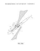 Suturing Devices and Methods for Closing a Patent Foramen Ovale diagram and image