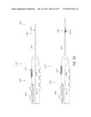 Suturing Devices and Methods for Closing a Patent Foramen Ovale diagram and image