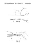 METHODS OF MAKING REINFORCED SOFT TISSUE GRAFTS WITH SUTURE LOOP/NEEDLE     CONSTRUCTS diagram and image
