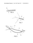 METHODS OF MAKING REINFORCED SOFT TISSUE GRAFTS WITH SUTURE LOOP/NEEDLE     CONSTRUCTS diagram and image