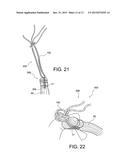 METHODS OF MAKING REINFORCED SOFT TISSUE GRAFTS WITH SUTURE LOOP/NEEDLE     CONSTRUCTS diagram and image