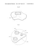 MODULARIZED PATIENT-SPECIFIC REGISTRATION GUIDE AND SYSTEM USING SAME diagram and image