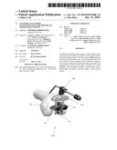 ANATOMICALLY GUIDED INSTRUMENTATION FOR TROCHLEAR GROOVE REPLACEMENT diagram and image