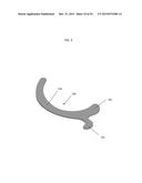 ANATOMICALLY GUIDED INSTRUMENTATION FOR TROCHLEAR GROOVE REPLACEMENT diagram and image