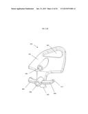 ANATOMICALLY GUIDED INSTRUMENTATION FOR TROCHLEAR GROOVE REPLACEMENT diagram and image