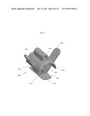 ANATOMICALLY GUIDED INSTRUMENTATION FOR TROCHLEAR GROOVE REPLACEMENT diagram and image