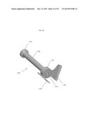 ANATOMICALLY GUIDED INSTRUMENTATION FOR TROCHLEAR GROOVE REPLACEMENT diagram and image