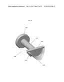 ANATOMICALLY GUIDED INSTRUMENTATION FOR TROCHLEAR GROOVE REPLACEMENT diagram and image