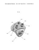 ANATOMICALLY GUIDED INSTRUMENTATION FOR TROCHLEAR GROOVE REPLACEMENT diagram and image