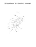 ANATOMICALLY GUIDED INSTRUMENTATION FOR TROCHLEAR GROOVE REPLACEMENT diagram and image