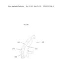 ANATOMICALLY GUIDED INSTRUMENTATION FOR TROCHLEAR GROOVE REPLACEMENT diagram and image