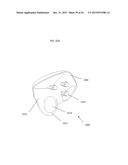 ANATOMICALLY GUIDED INSTRUMENTATION FOR TROCHLEAR GROOVE REPLACEMENT diagram and image