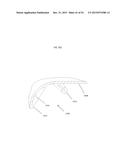 ANATOMICALLY GUIDED INSTRUMENTATION FOR TROCHLEAR GROOVE REPLACEMENT diagram and image