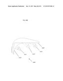 ANATOMICALLY GUIDED INSTRUMENTATION FOR TROCHLEAR GROOVE REPLACEMENT diagram and image