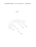 ANATOMICALLY GUIDED INSTRUMENTATION FOR TROCHLEAR GROOVE REPLACEMENT diagram and image