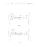 APPARATUS AND METHODS FOR ACCESSING AND REMOVING MATERIAL FROM BODY LUMENS diagram and image